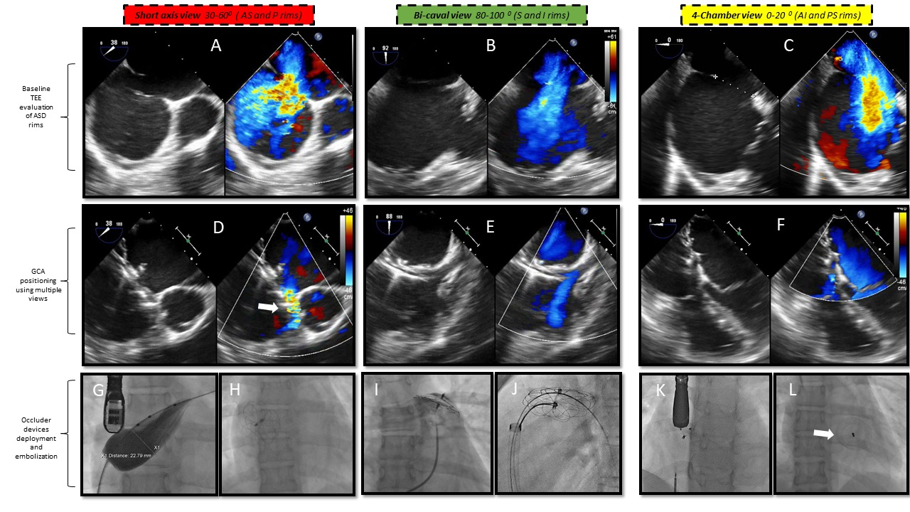 Figure 3. TEE evaluation