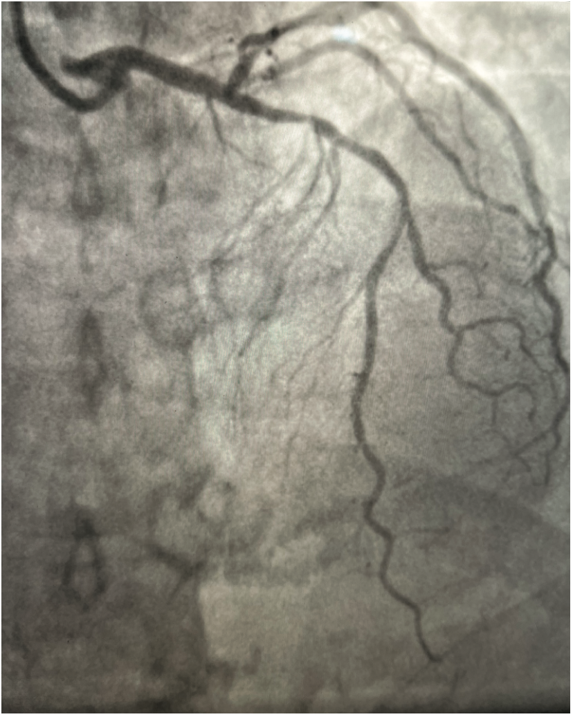 Lata Defibrillator Figure 1