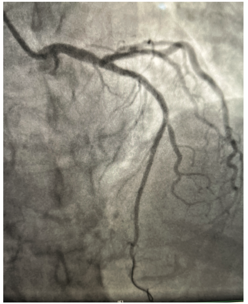Lata Defibrillator Figure 3