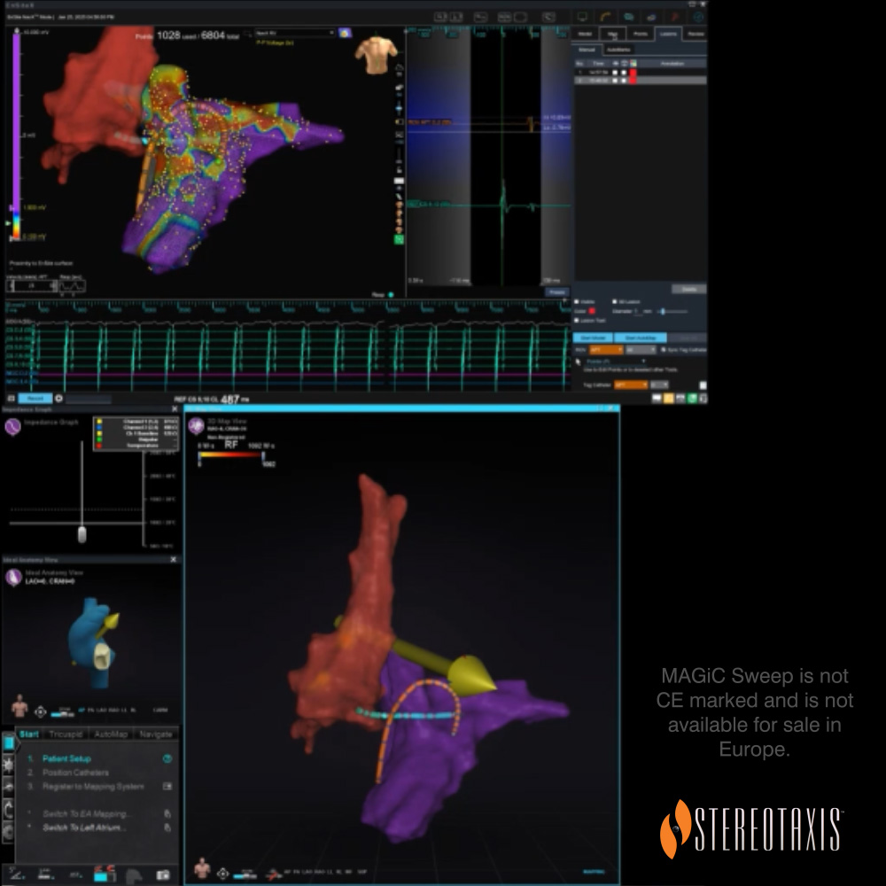 Left ventricle map created during testing using MAGiC Sweep advanced robotic mapping catheter