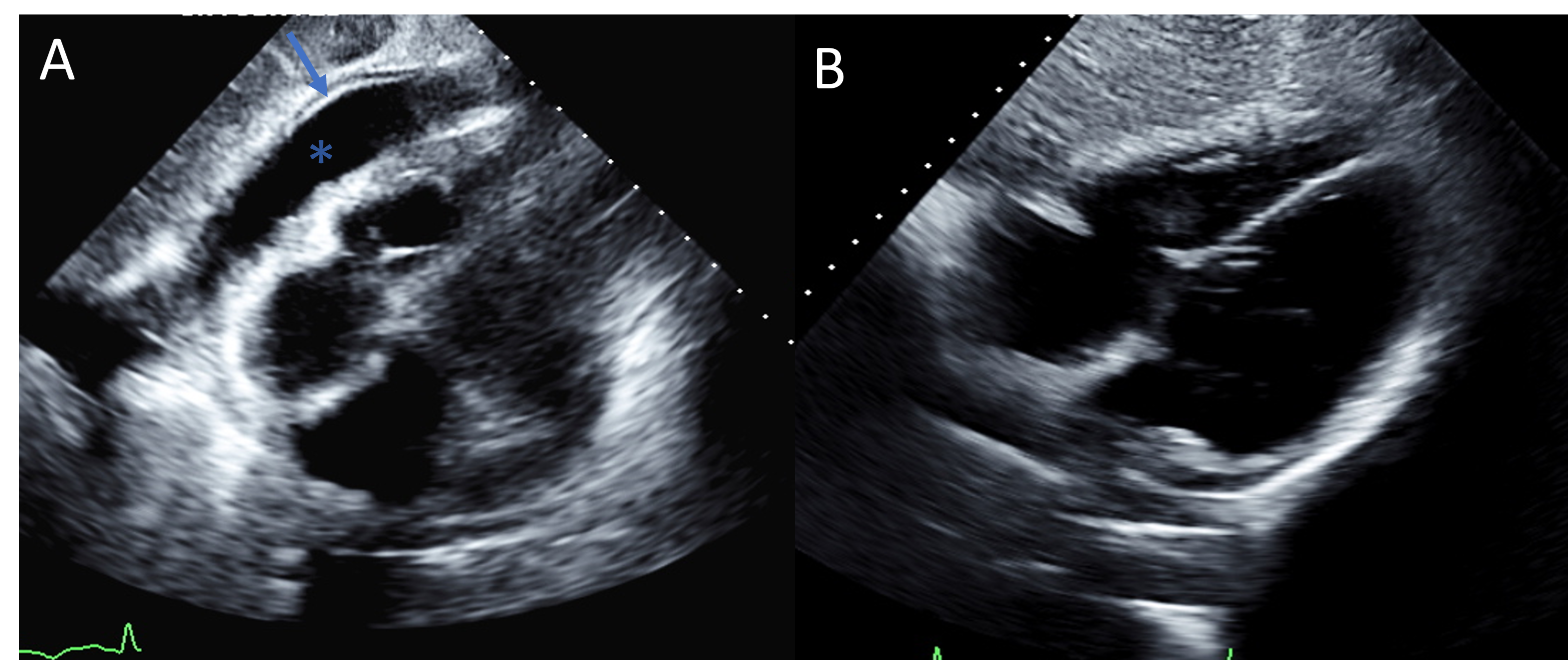 Figure 1. Echocardiographic changes