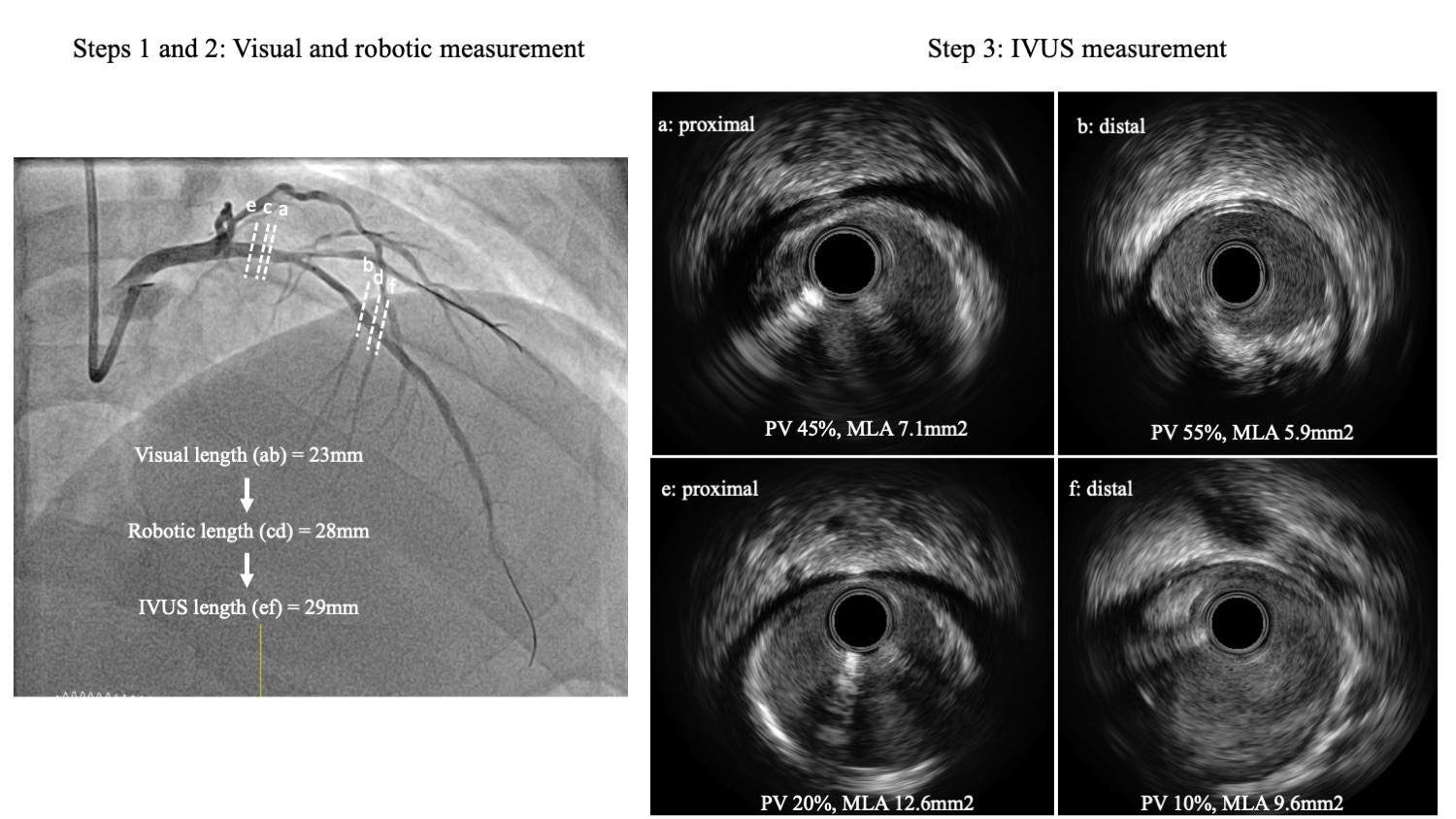 Figure 1. Illustrative case comparing visual, robotic, and imaging length