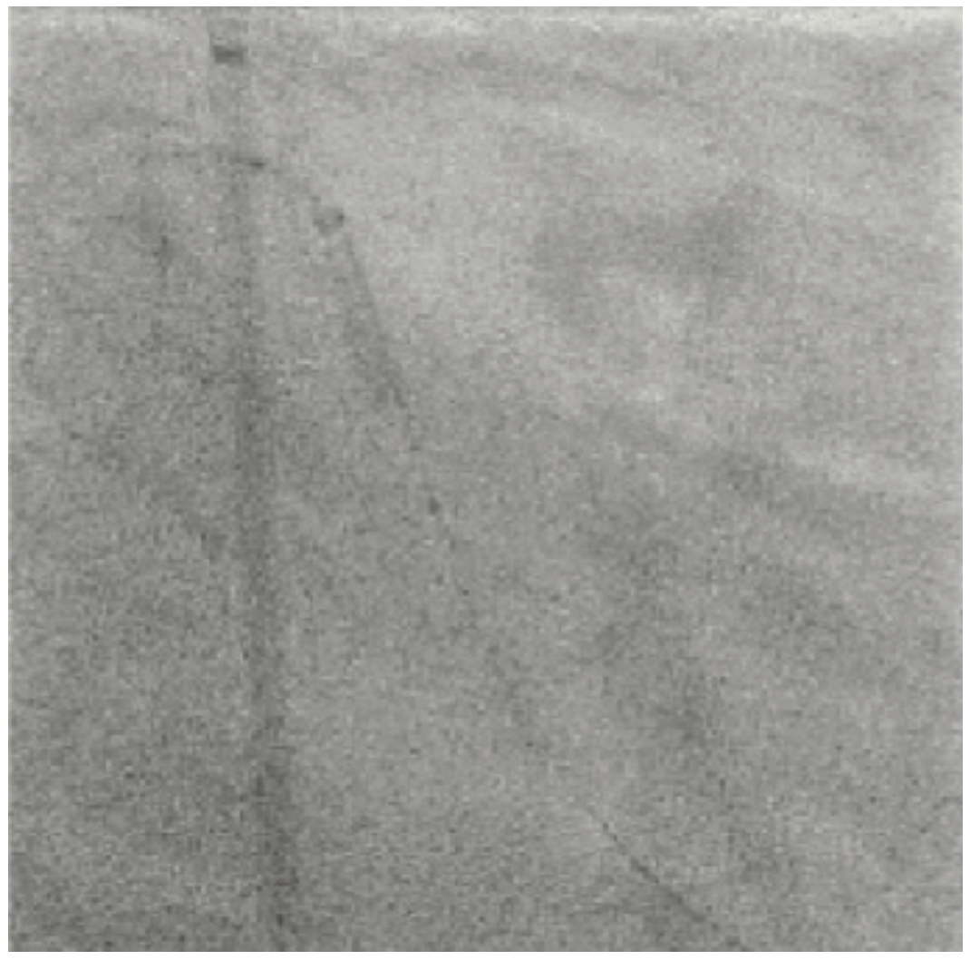 Lichaa Guide Catheter Figure 12