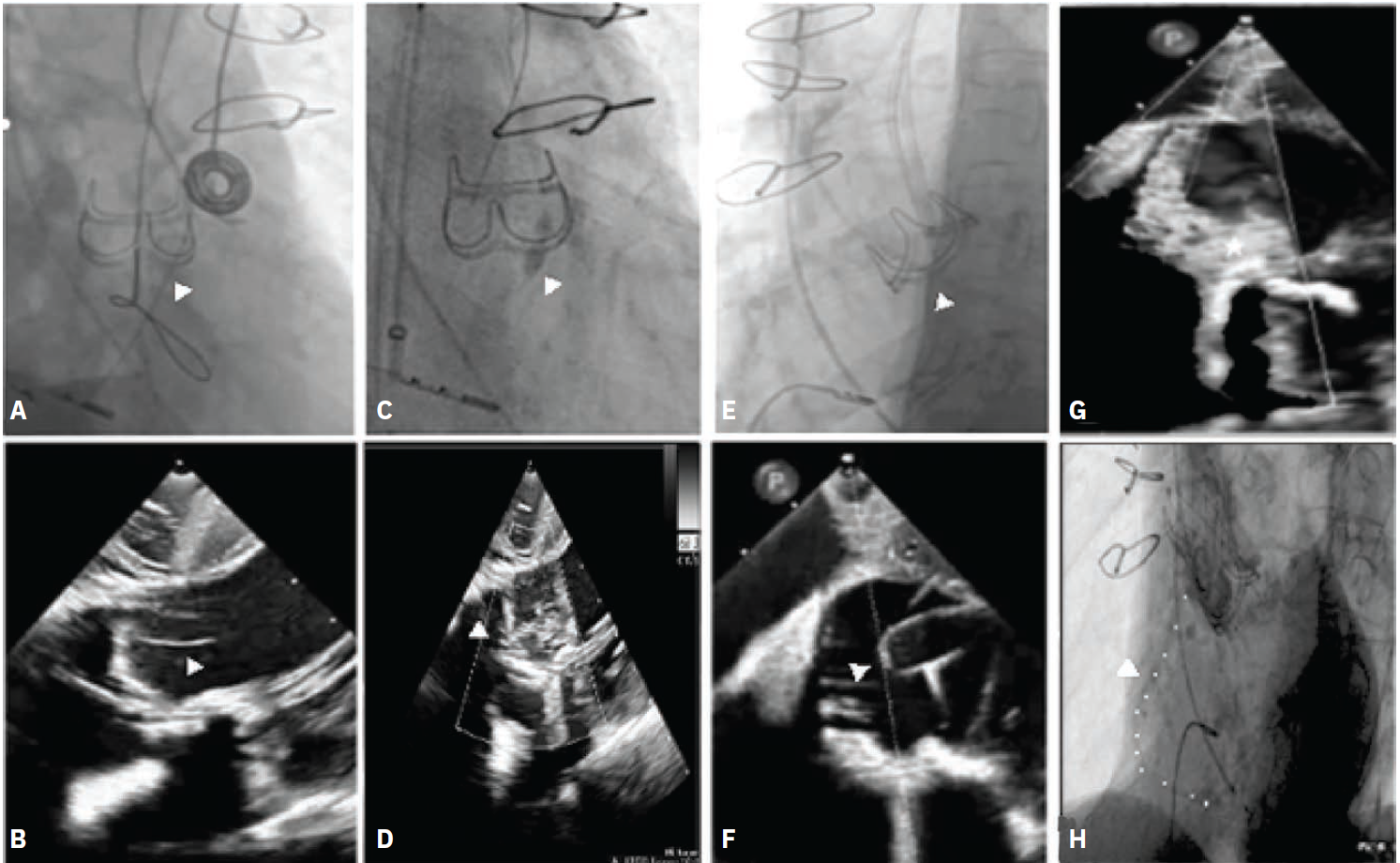 Little-Figure-CLD-Nov 2024 