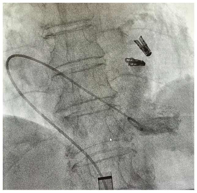 Lo Cardiac Pacing Figure 3