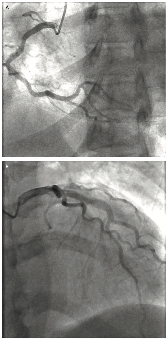 Locklear Kidney Transplant Figure 1
