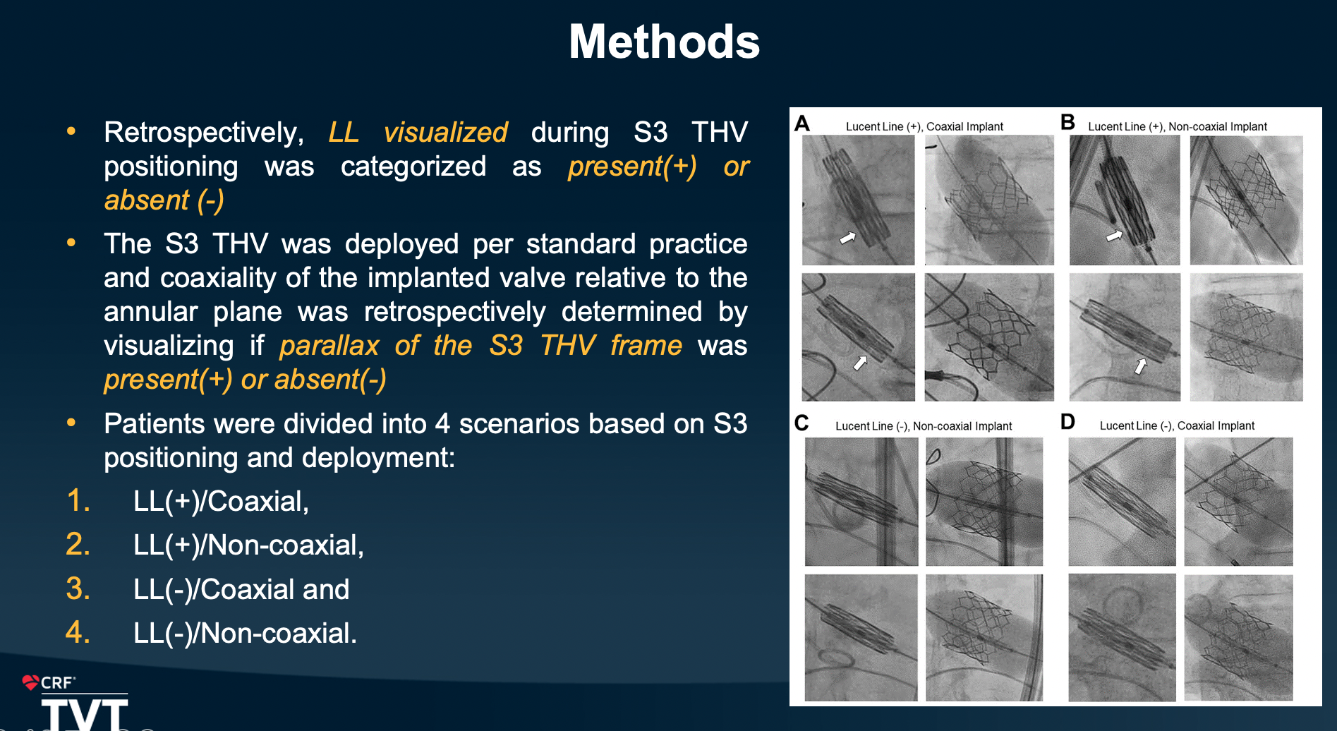 Lucent Line TVT Gilbert Tang, MD