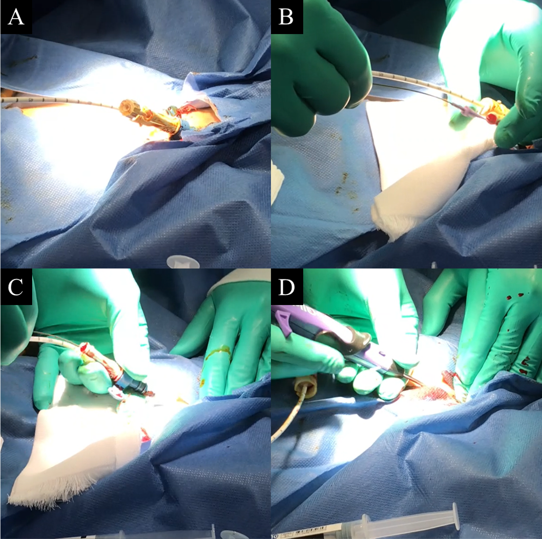 Figure 2. Procedure description