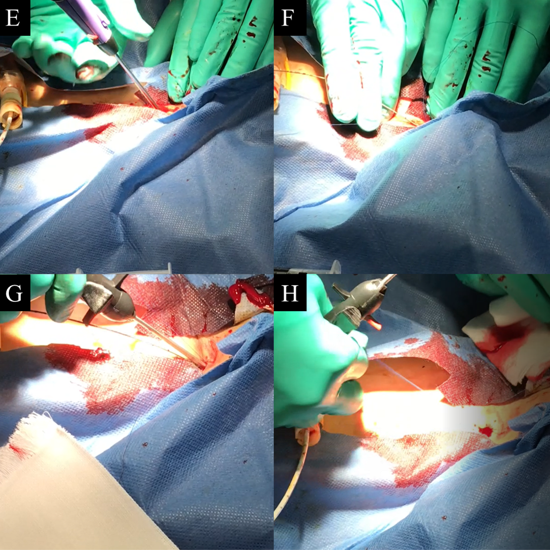 Figure 2. Procedure description. 