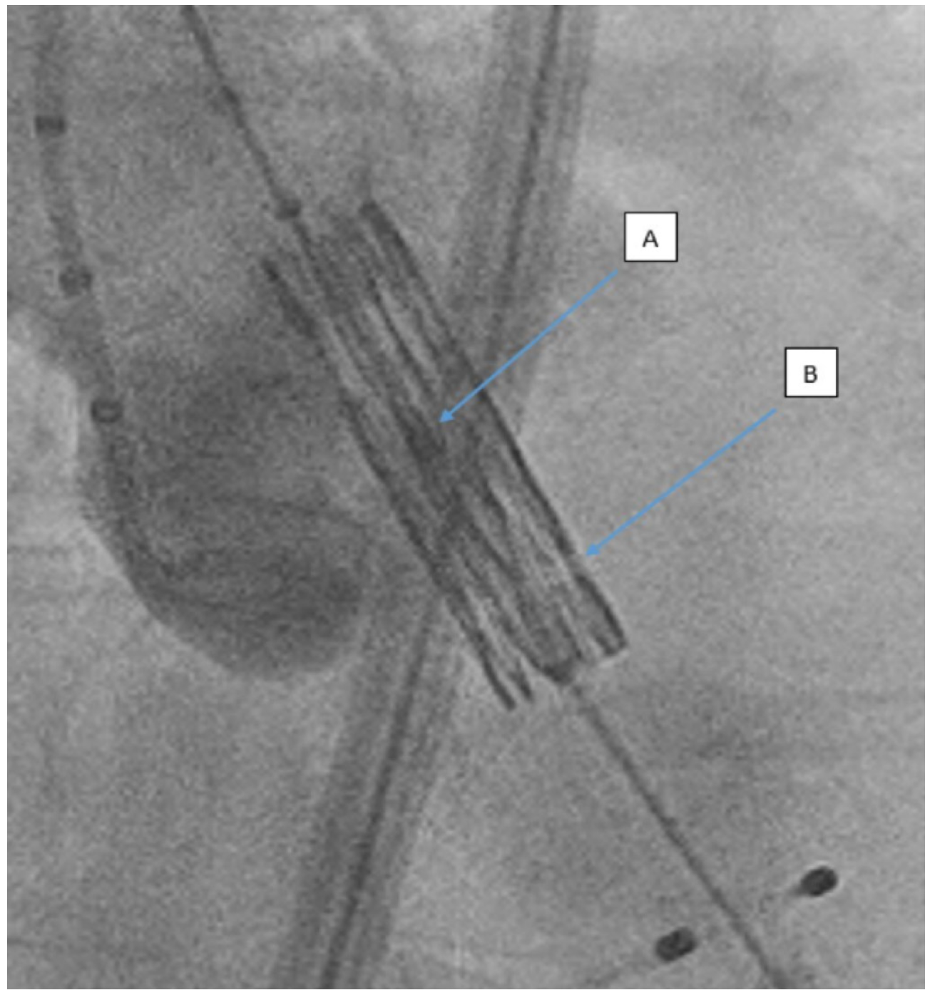 Mailey et al JIC Lucent Line Figure 2