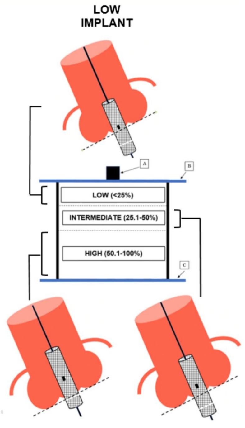 Mailey Transcatheter Figure 4