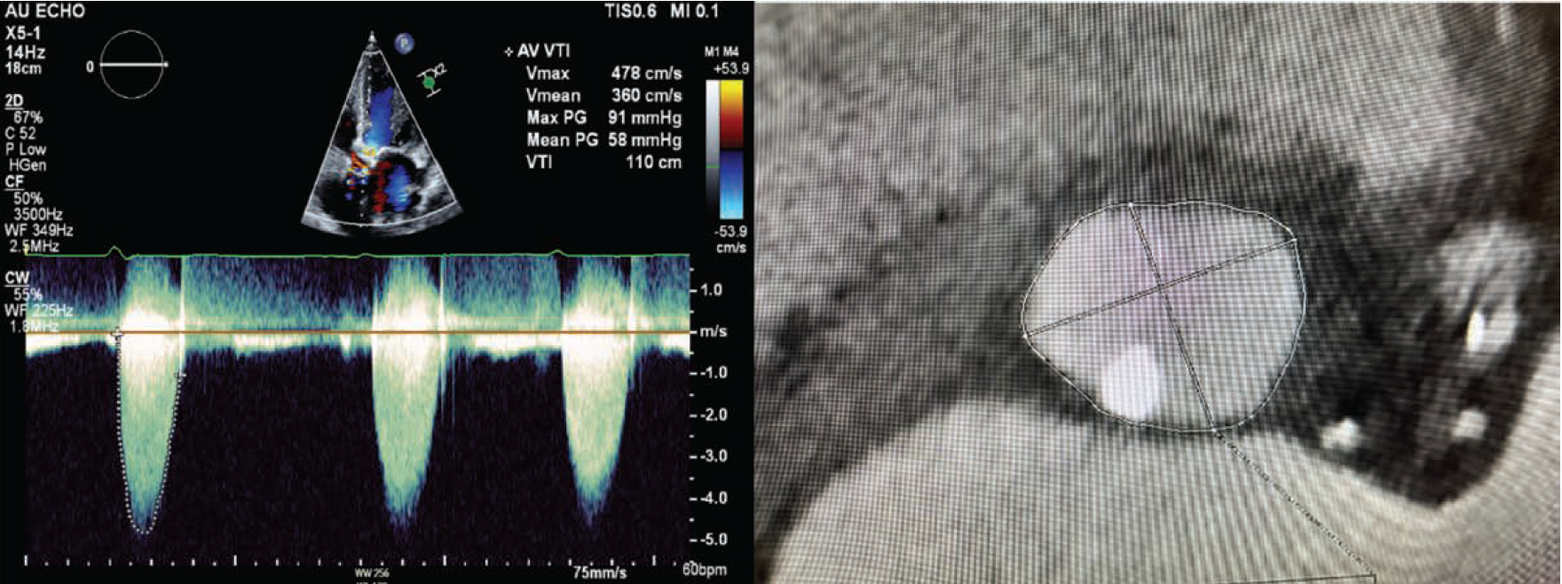 Manasrah-Fig1-CLD-FEB
