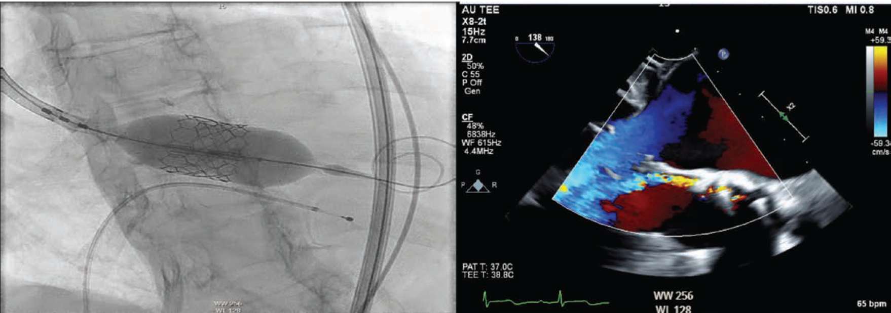 Manasrah-Fig2-CLD-FEB
