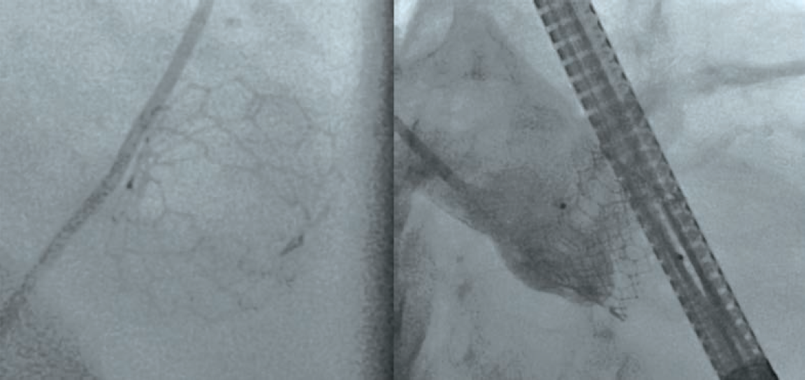 Manasrah-Fig3-CLD-FEB