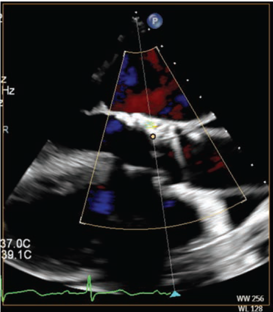 Manasrah-Fig4-CLD-FEB
