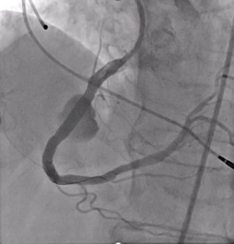 Figure 9
