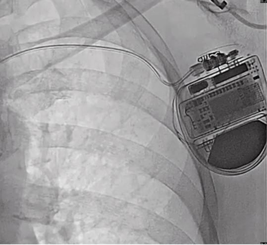 Mareddy - Fig 1 - Nov 2024