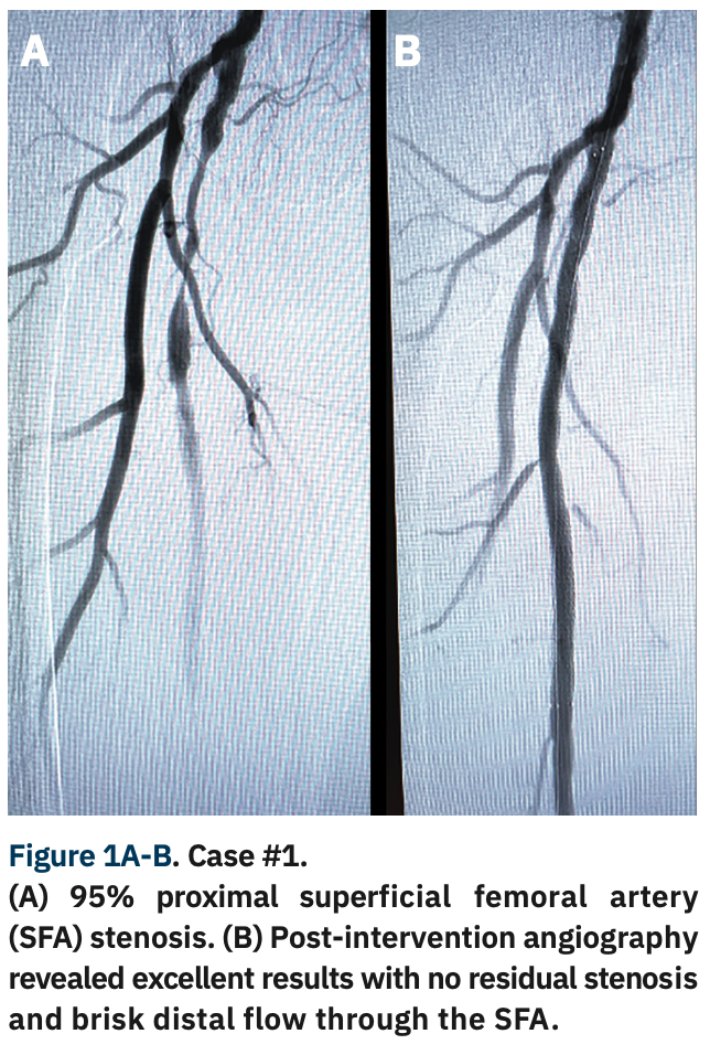 Markiewicz Radial Interventions Figure 1
