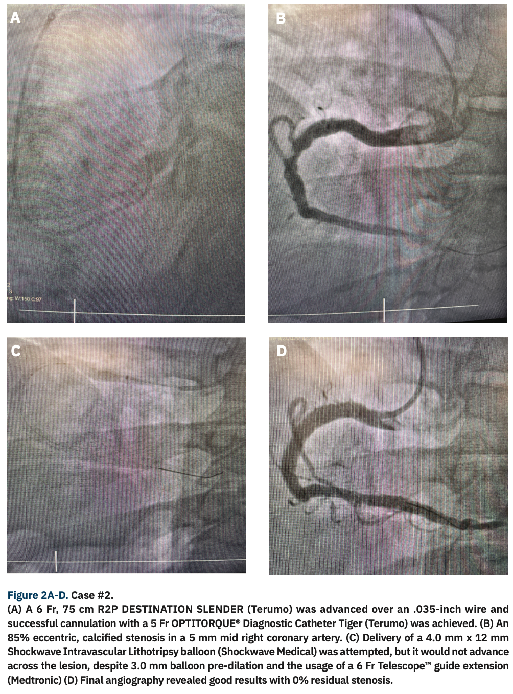 Markiewicz Radial Interventions Figure 2