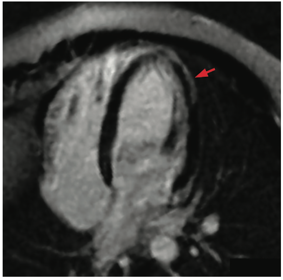 Martinez COVID Figure 2