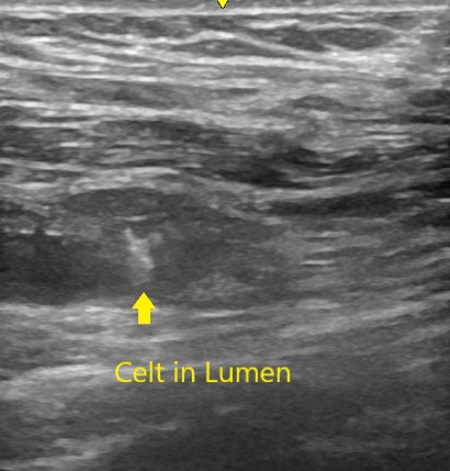 MartinezVDM_Access_Fig1A