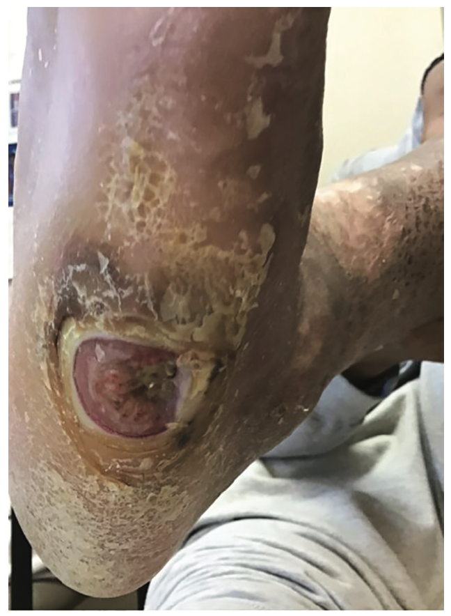 Meisner Serranator PTA Figure 1