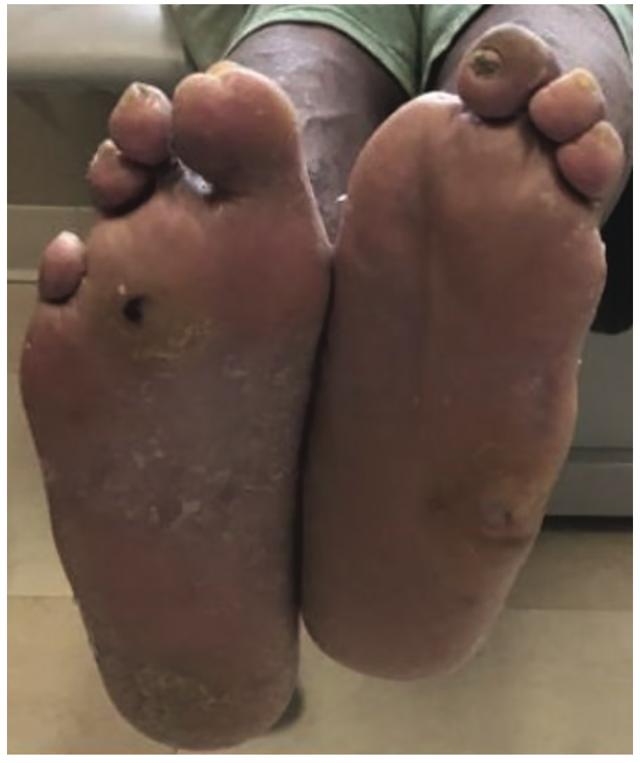 Meisner Serranator PTA Figure 7