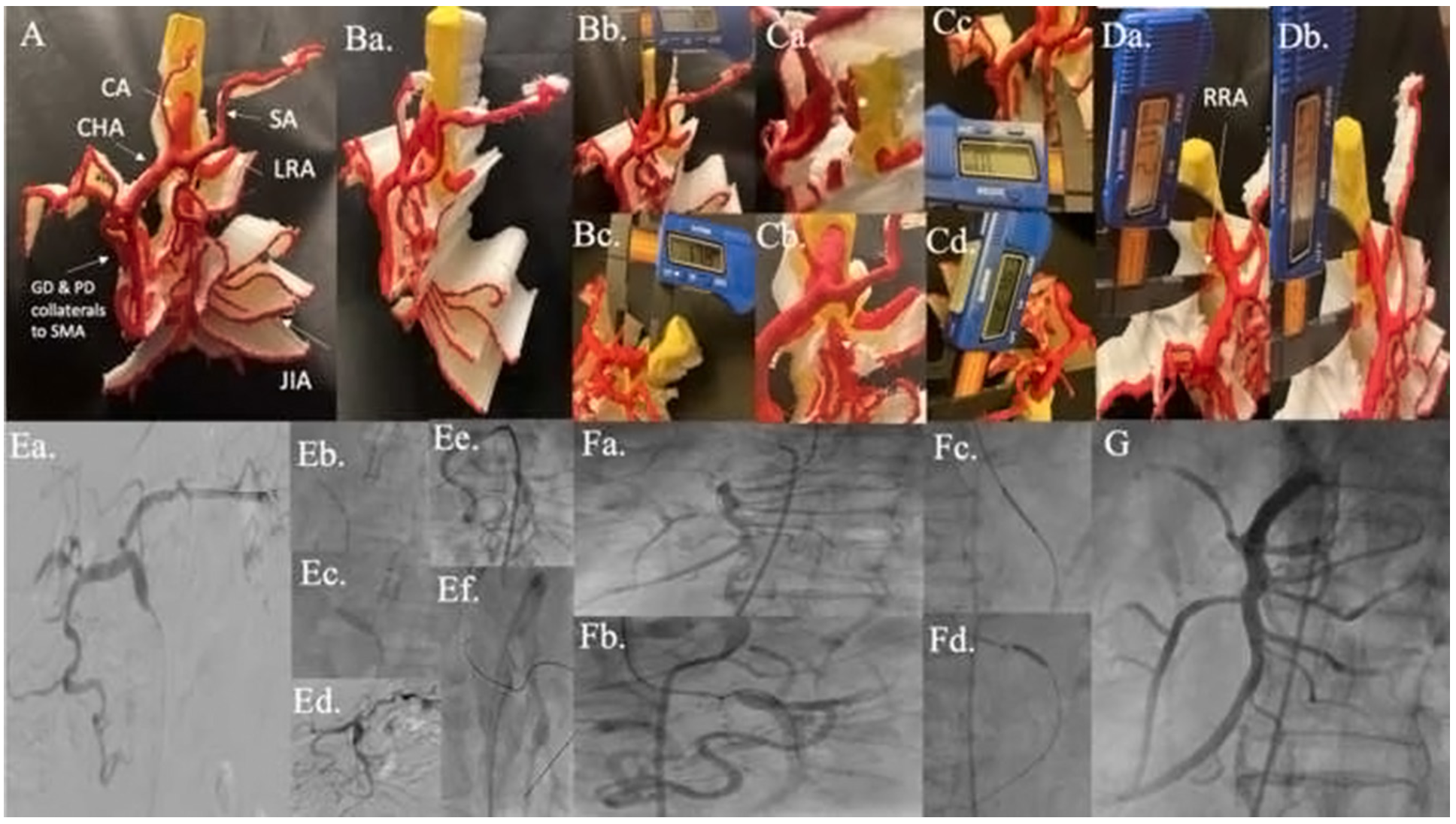 Memon Mesenteric Artery Figure 2