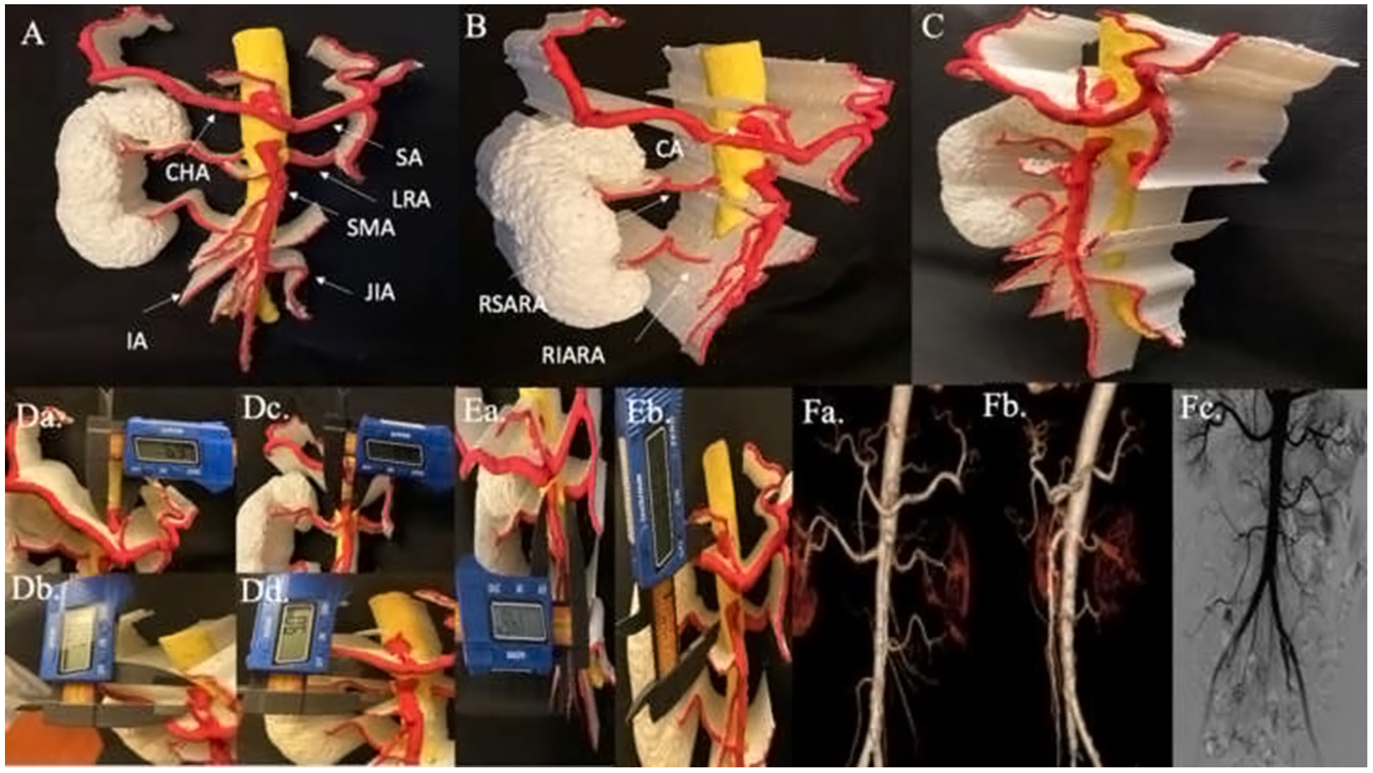Memon Mesenteric Artery Figure 4