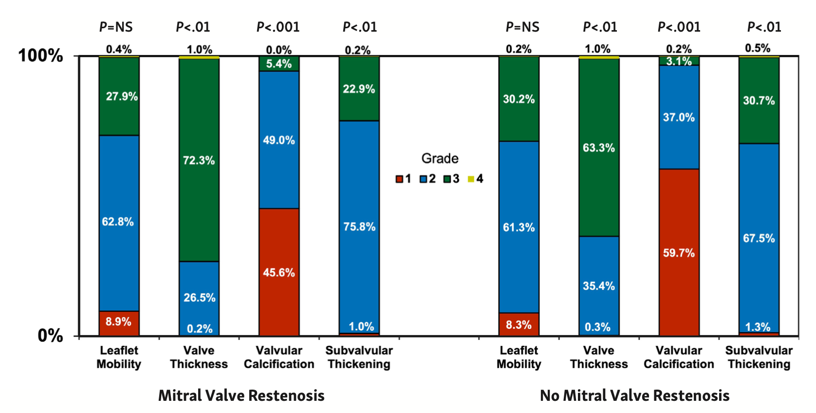 Meneguz-Moreno Balloon Commissurotomy Figure 2