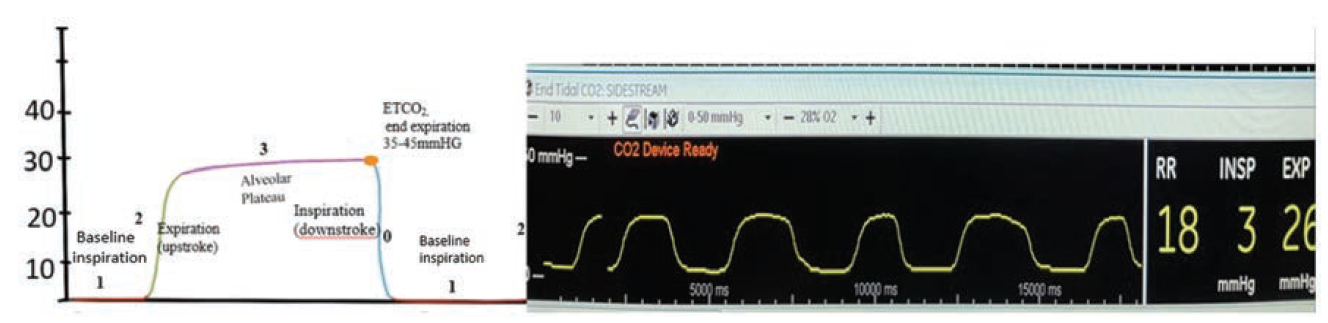 Merschen - Fig 4 - June 2024