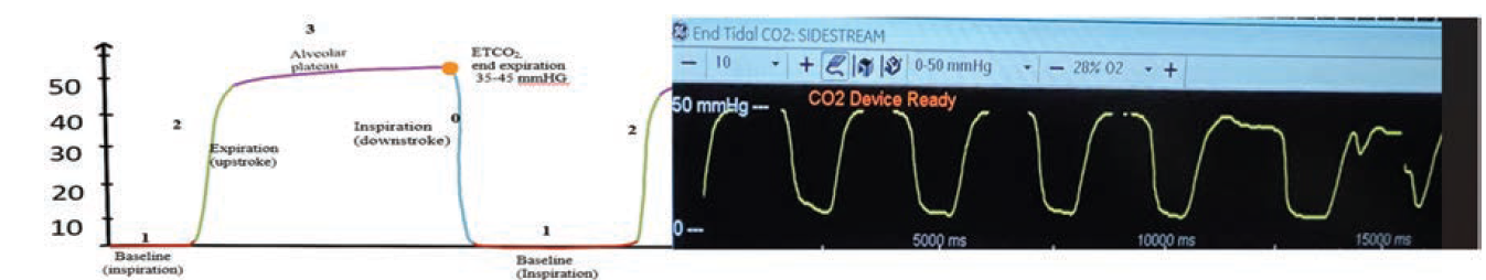 Merschen - Fig 5 - June 2024