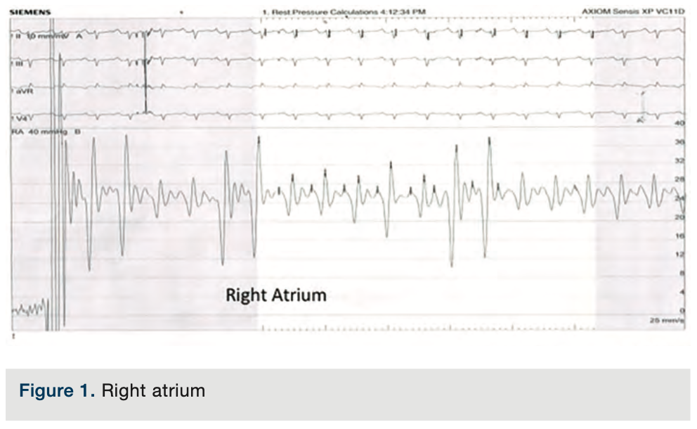 Merschen Hemodynamics Figure 1