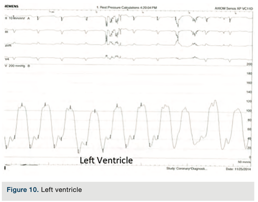 Merschen Hemodynamics Figure 10