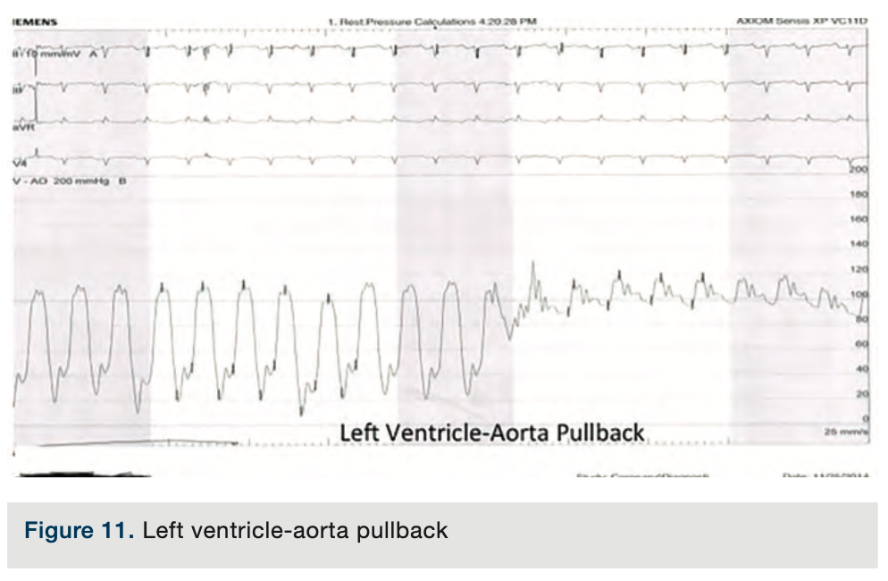 Merschen Hemodynamics Figure 11