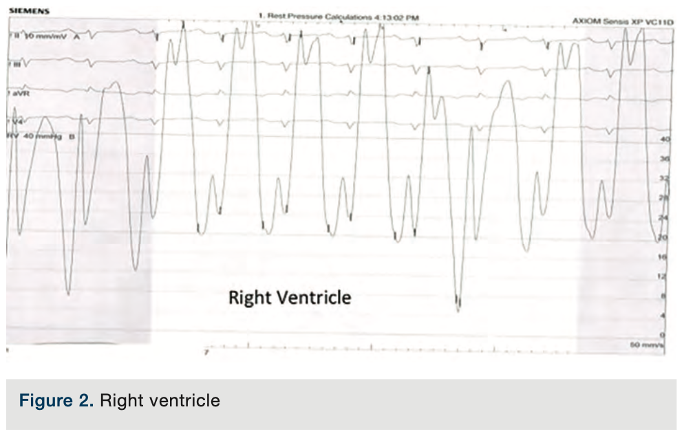 Merschen Hemodynamics Figure 2