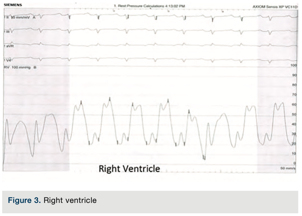 Merschen Hemodynamics Figure 3