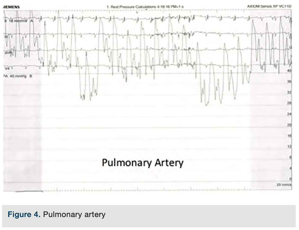 Merschen Hemodynamics Figure 4