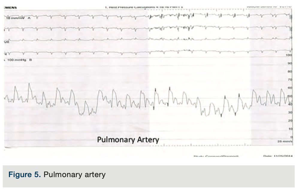 Merschen Hemodynamics Figure 5