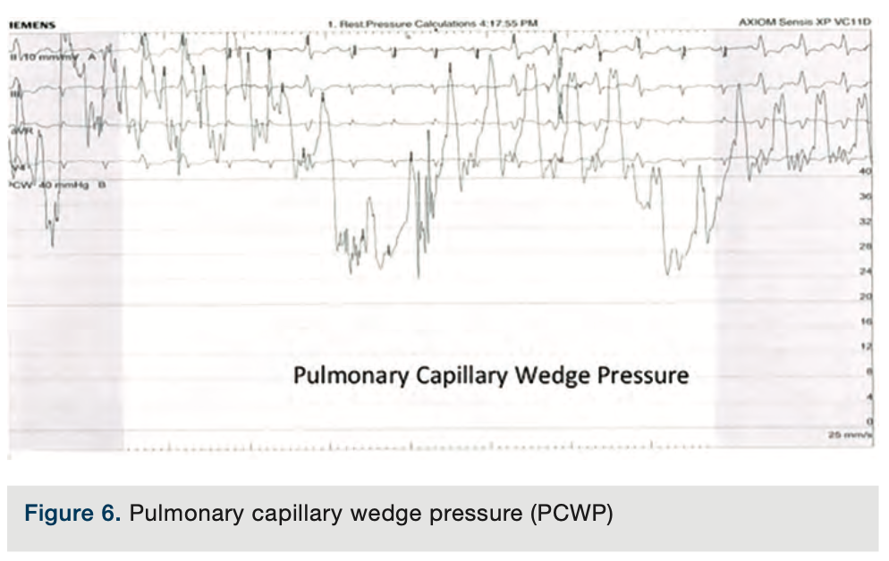 Merschen Hemodynamics Figure 6