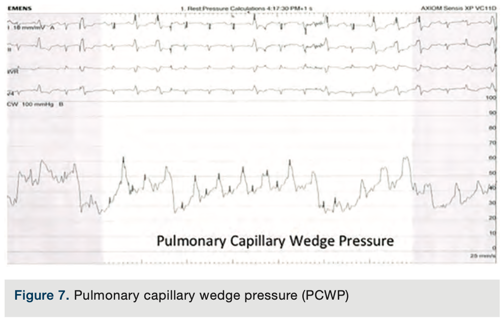 Merschen Hemodynamics Figure 7