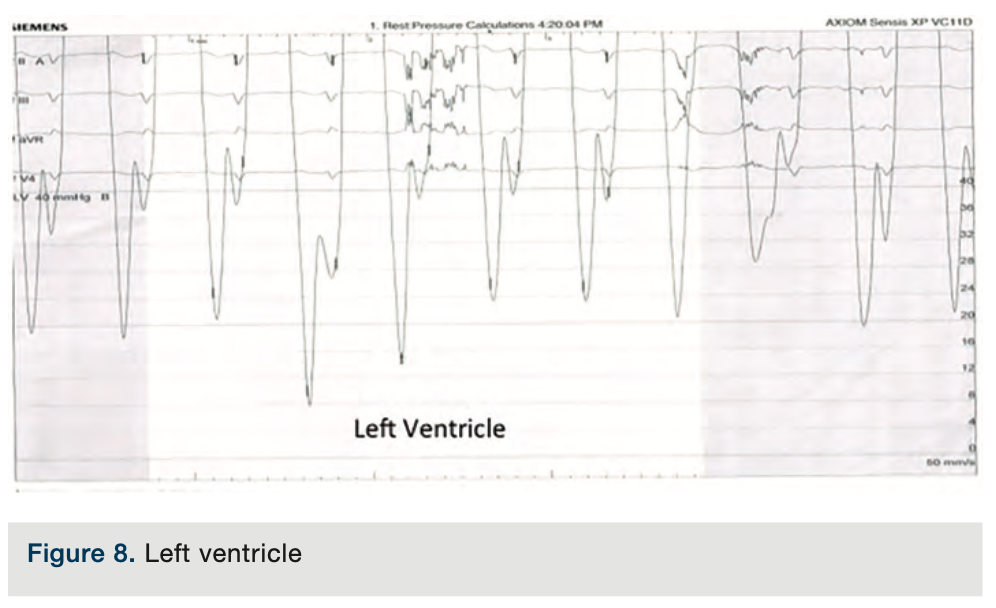 Merschen Hemodynamics Figure 8