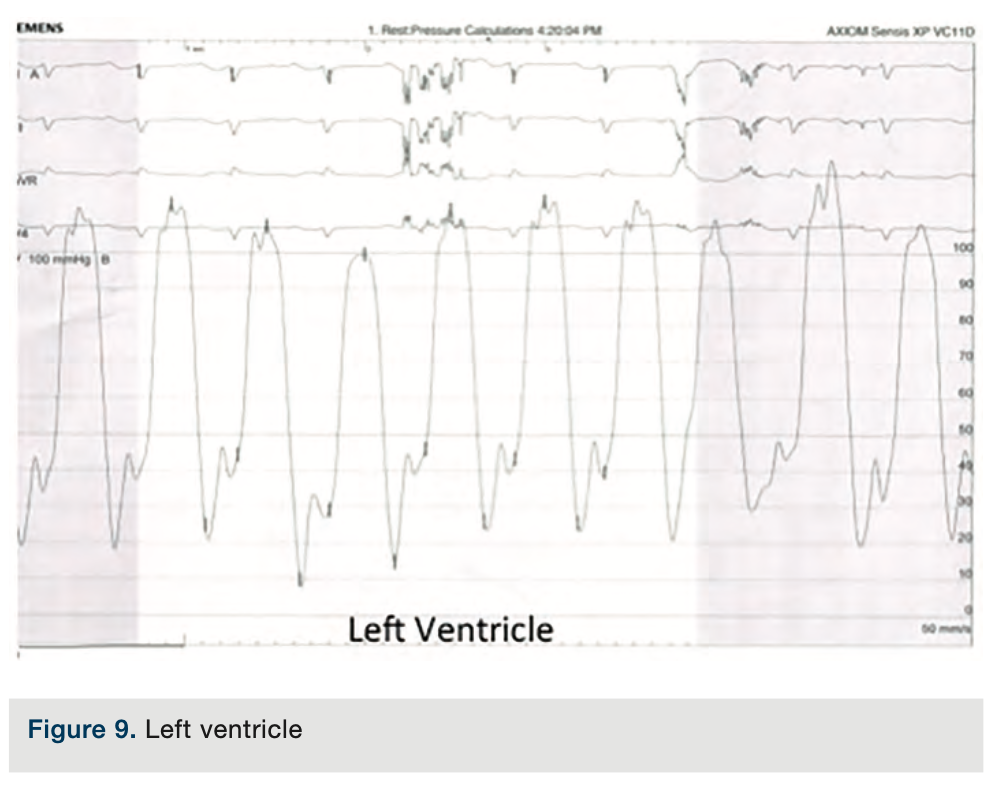 Merschen Hemodynamics Figure 9