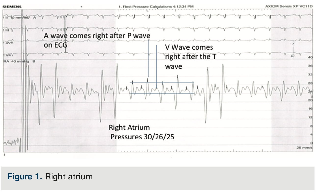 Merschen HemodynamicsPart2 Figure 1