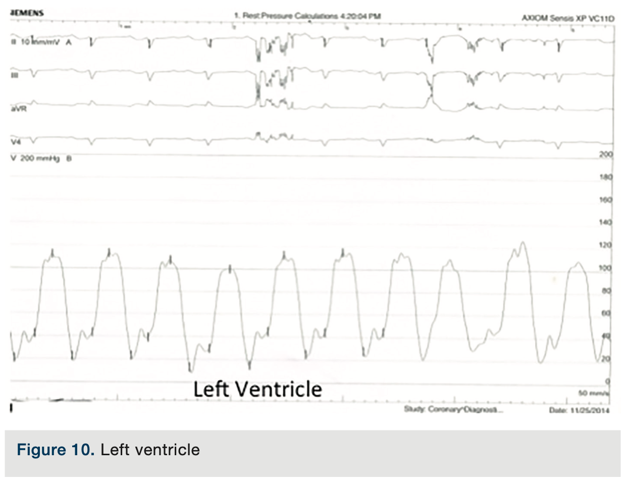 Merschen HemodynamicsPart2 Figure 10