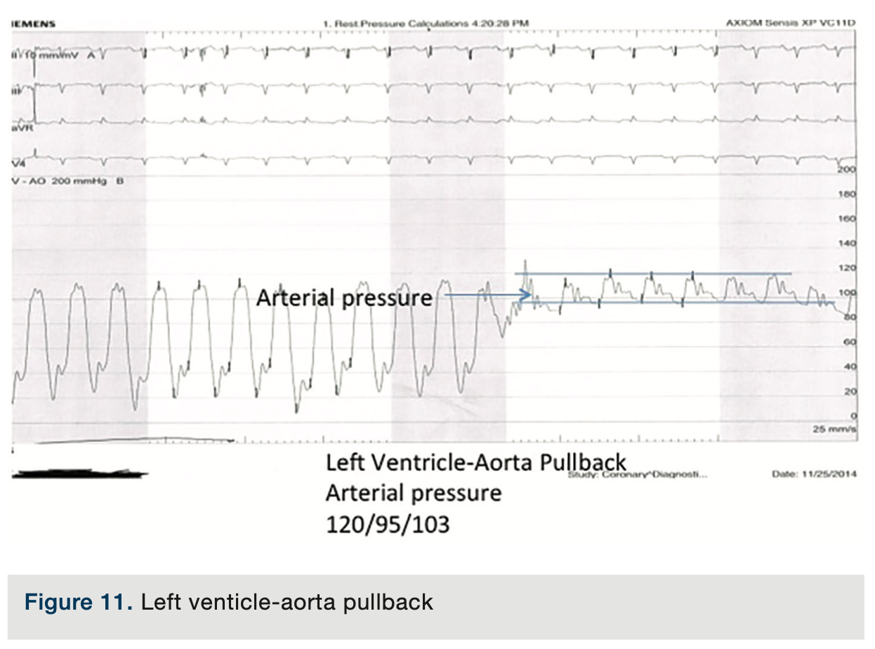 Merschen HemodynamicsPart2 Figure 11
