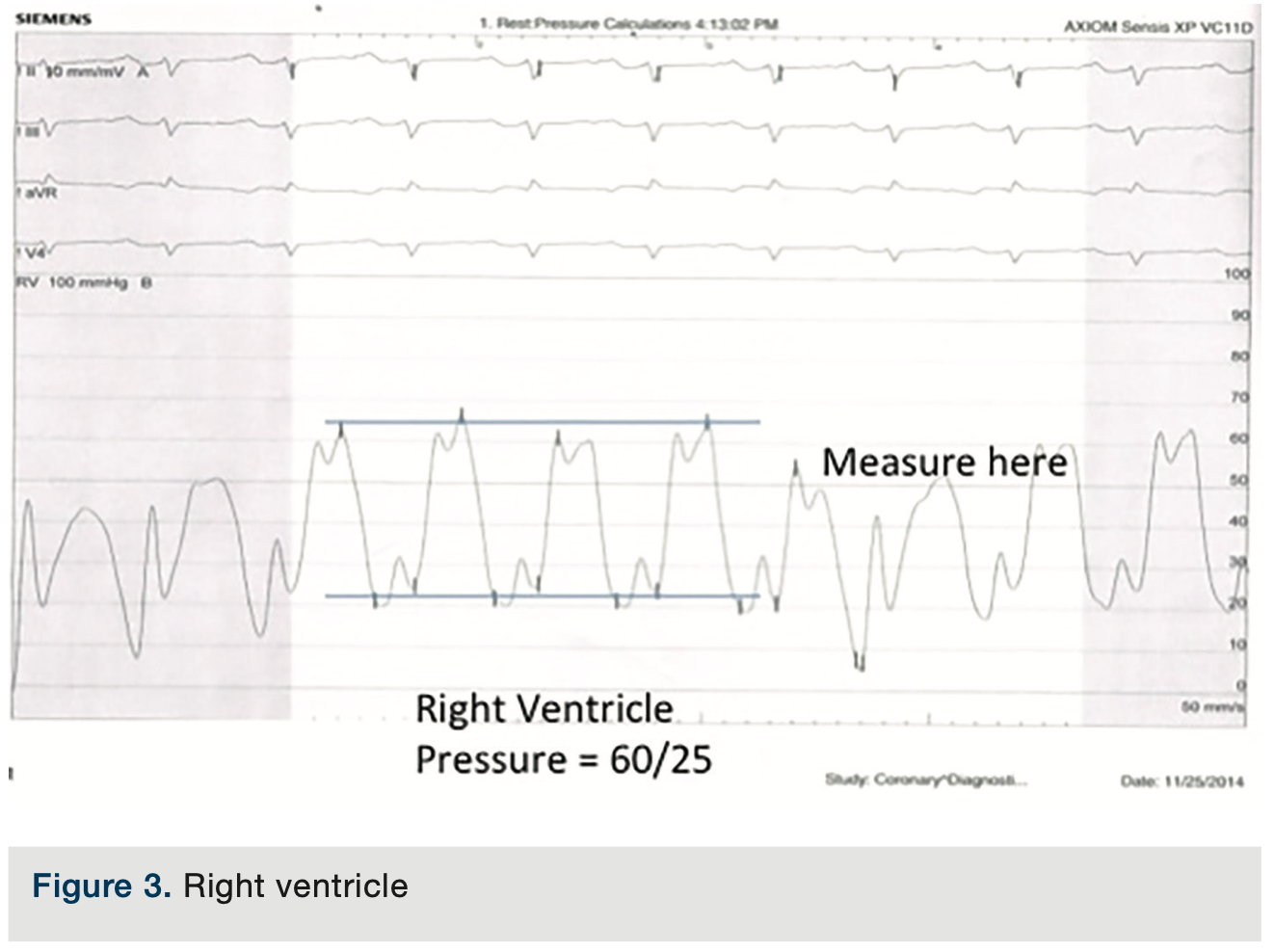 Merschen HemodynamicsPart2 Figure 3