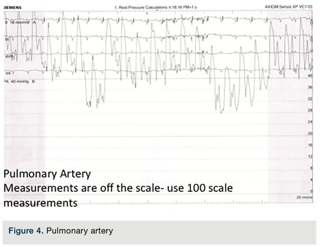 Merschen HemodynamicsPart2 Figure 4