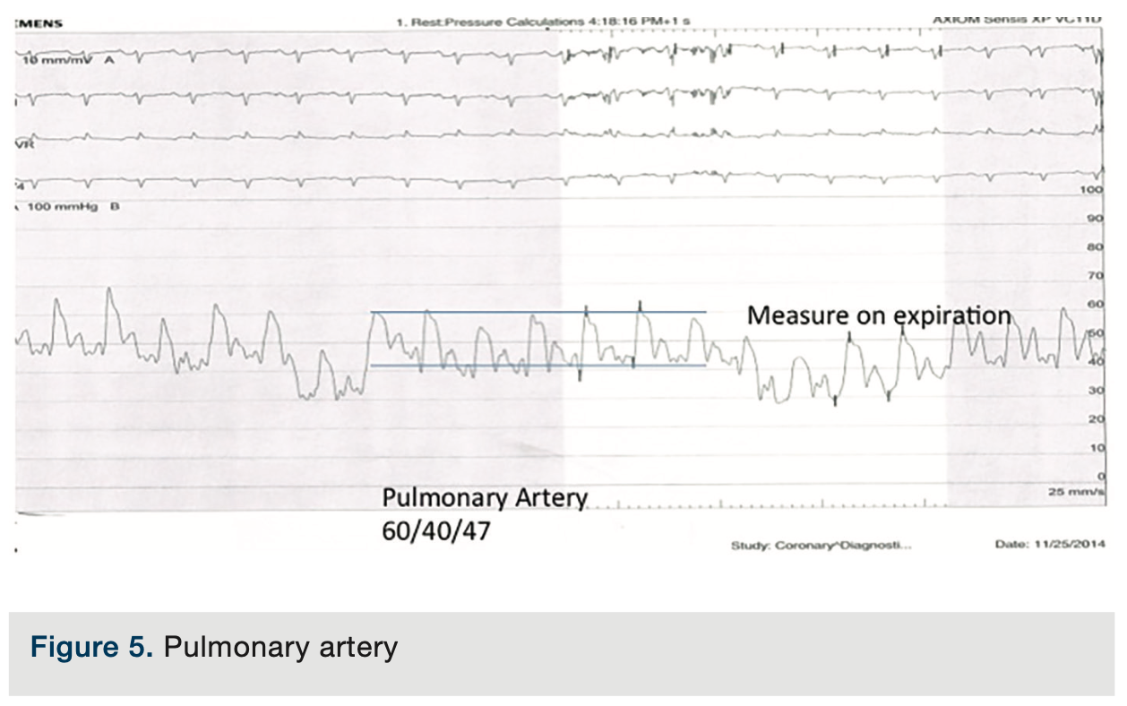 Merschen HemodynamicsPart2 Figure 5