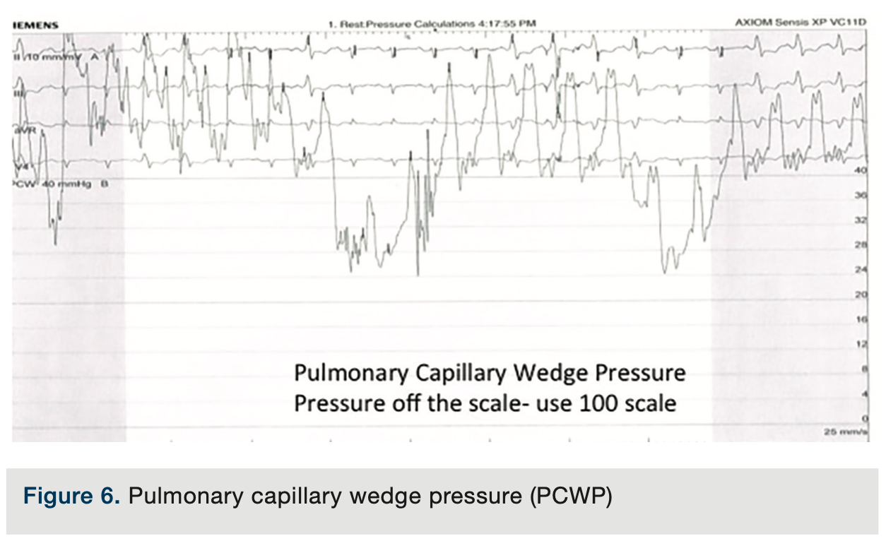 Merschen HemodynamicsPart2 Figure 6